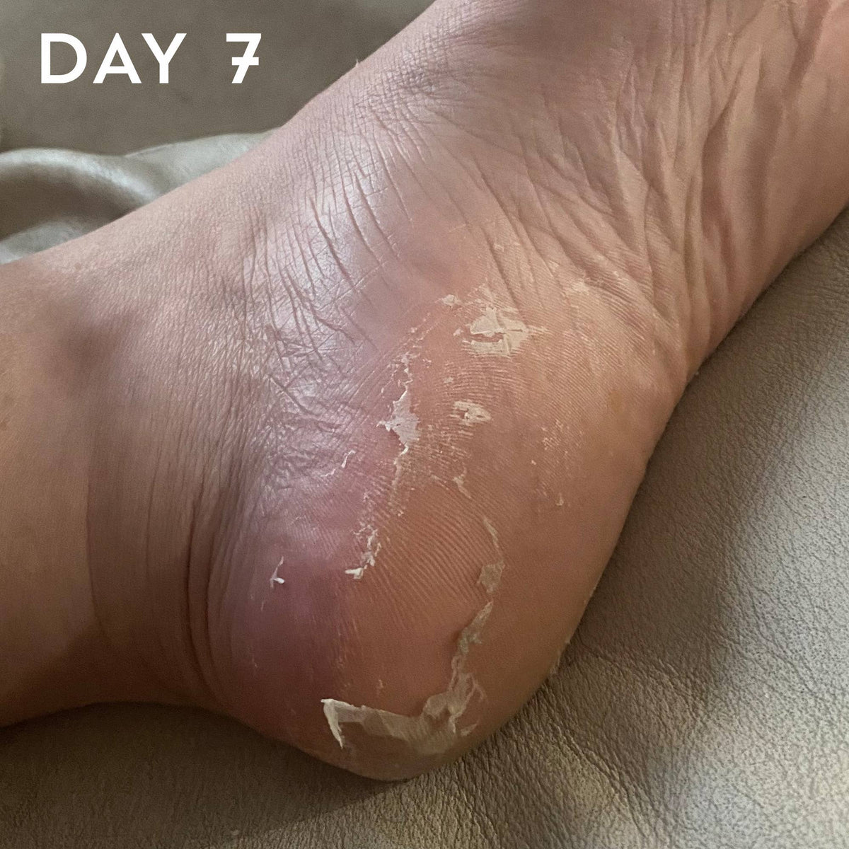 +maskology FOOT PEEL Professional Foot Treatment