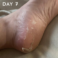 +maskology FOOT PEEL Professional Foot Treatment