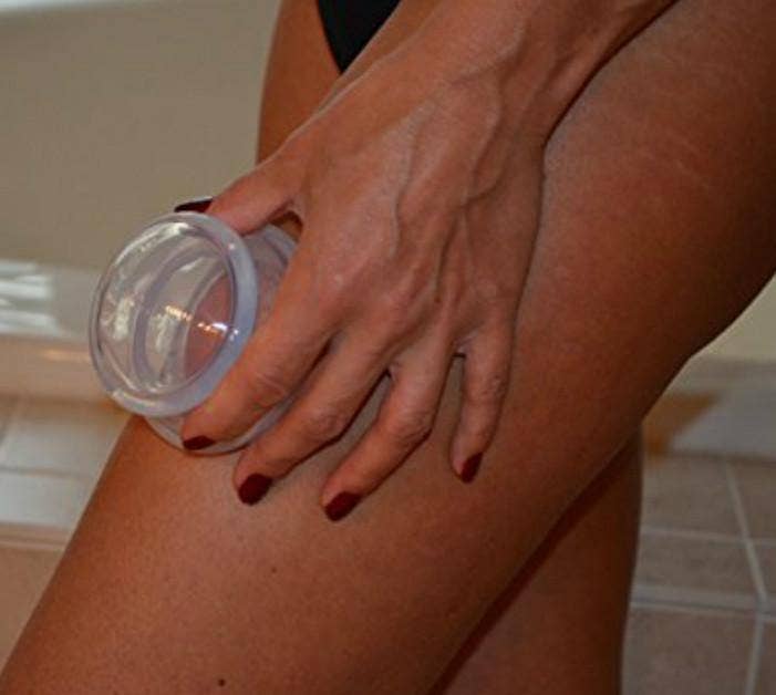 Body Cupping Therapy Set, Clear - 4 Cups