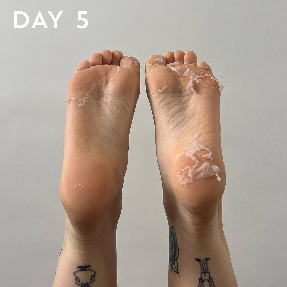 +maskology FOOT PEEL Professional Foot Treatment