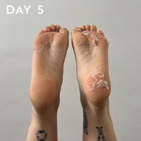 +maskology FOOT PEEL Professional Foot Treatment